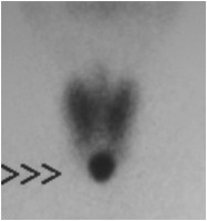 thyroid image 2b