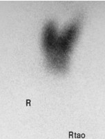 thyroid image 2c