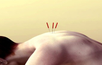 intractable pain