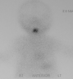 Thyroid Case 7a