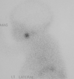 Thyroid Case 7b