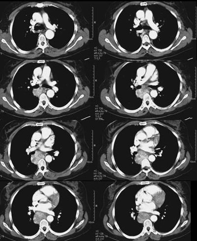 scan image
