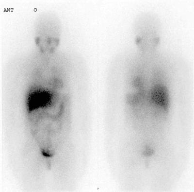 scan image