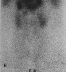 thyroid image 3a