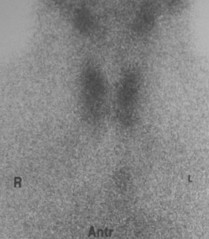 thyroid image 4a