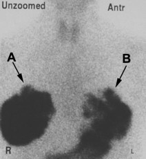 thyroid image 4d