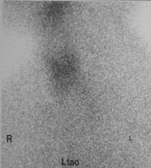 thyroid image 4c