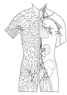 Lymphoedema node diagram