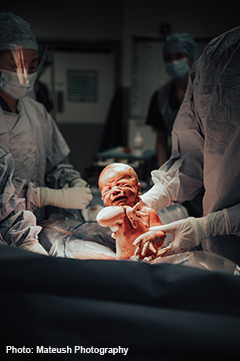 Baby being born by Caesarian