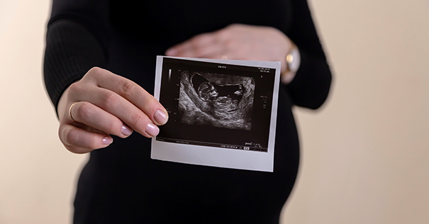 Pregnant woman holding up a picture of an ultrasound scan