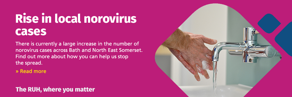 Rise in local norovirus cases