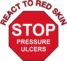 Stop Pressure Ulcers